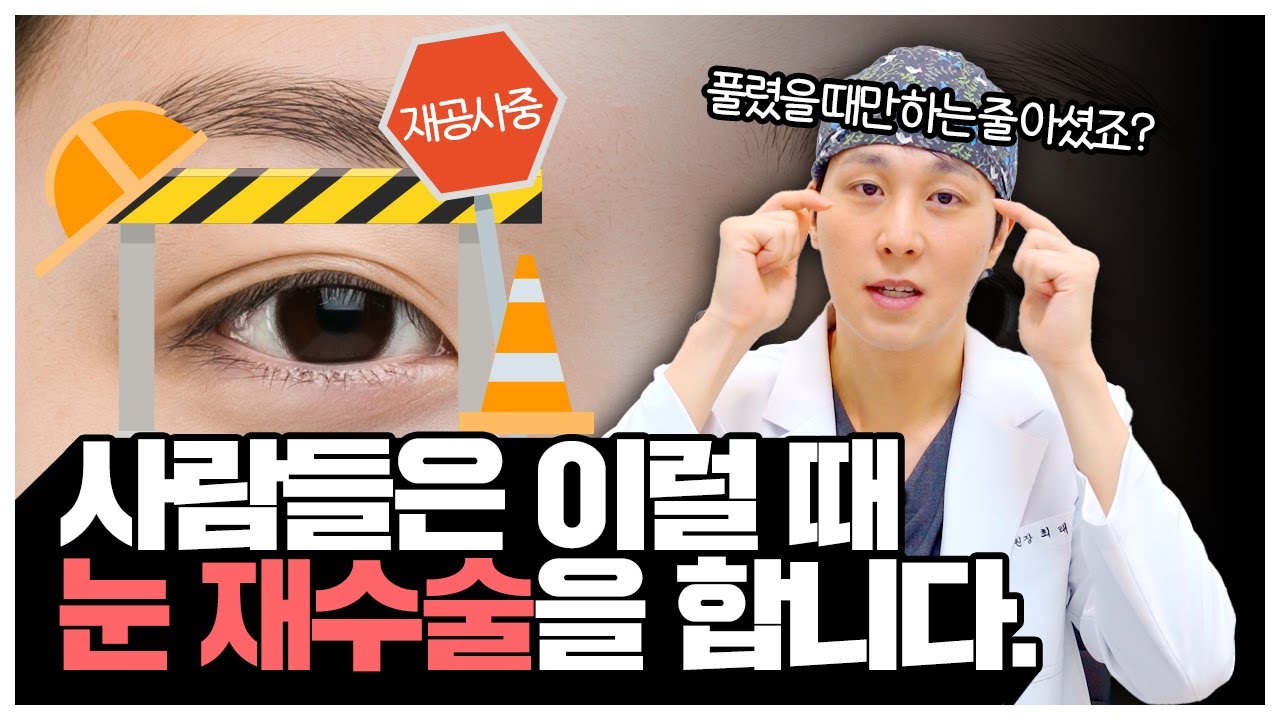 눈재수술 | 워나성형외과