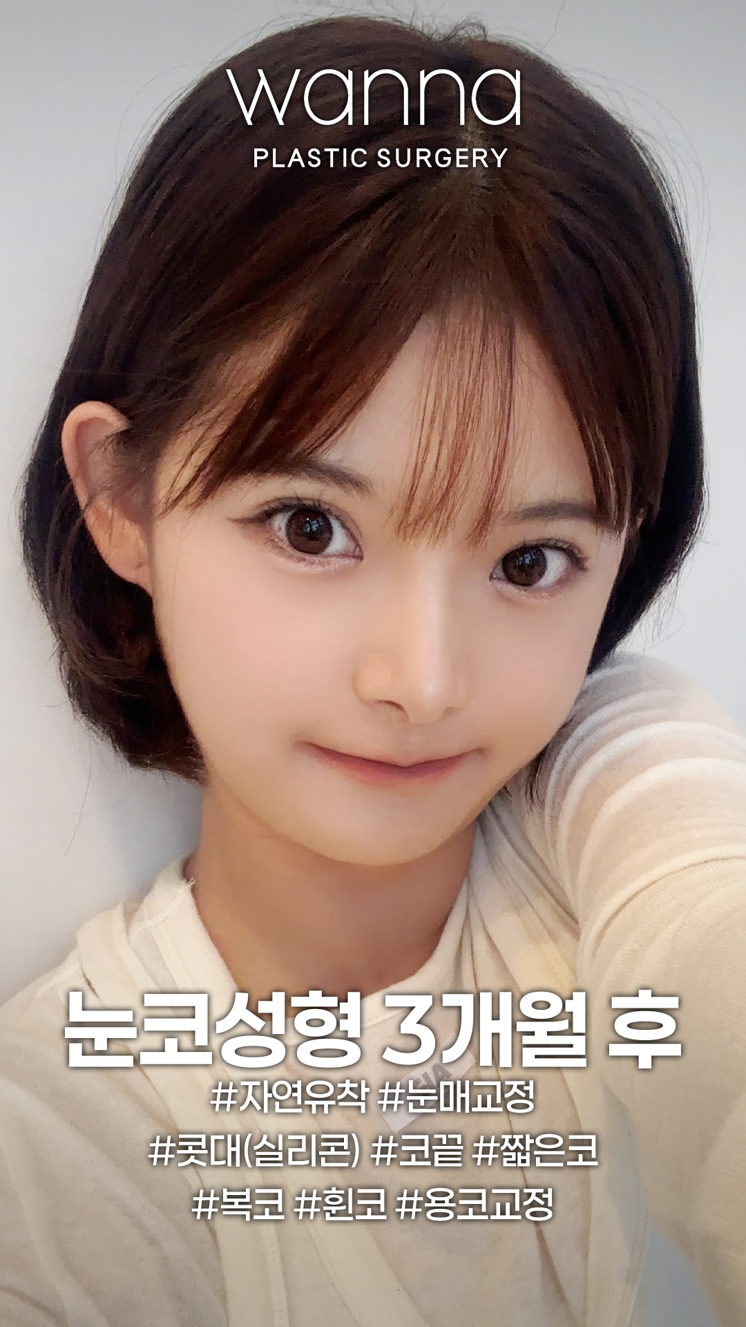 251210 워나홈피-쇼츠 섬네일 복사-조윤채3 | 워나성형외과