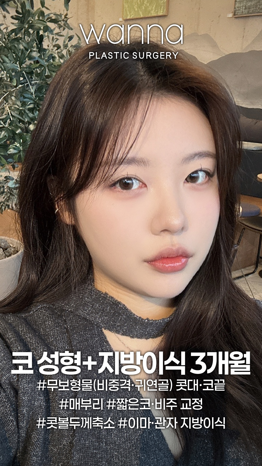 251210 워나홈피-쇼츠 섬네일 복사-최은비 | 워나성형외과